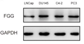 Relative FGG protein expression in PCa cell lines.jpg